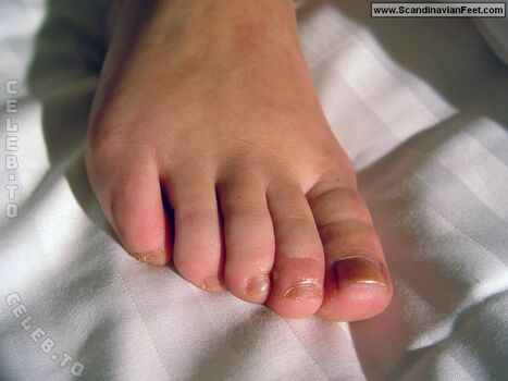 Scandinavian Feet